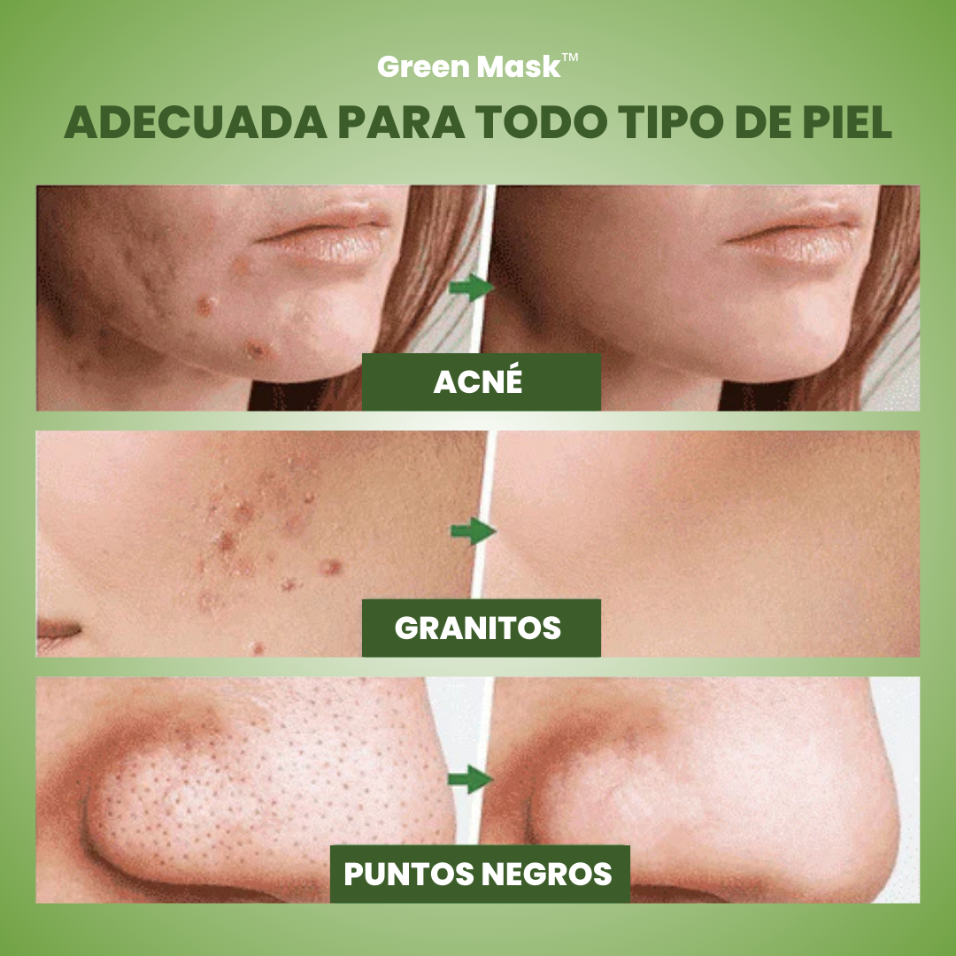 Mascarilla Verde Green Mask™ - Piel Renovada e Hidratada