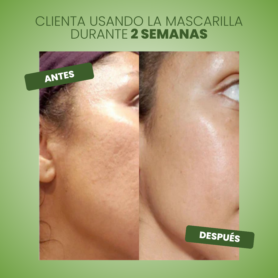 Mascarilla Verde Green Mask™ - Piel Renovada e Hidratada