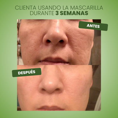 Mascarilla Verde Green Mask™ - Piel Renovada e Hidratada