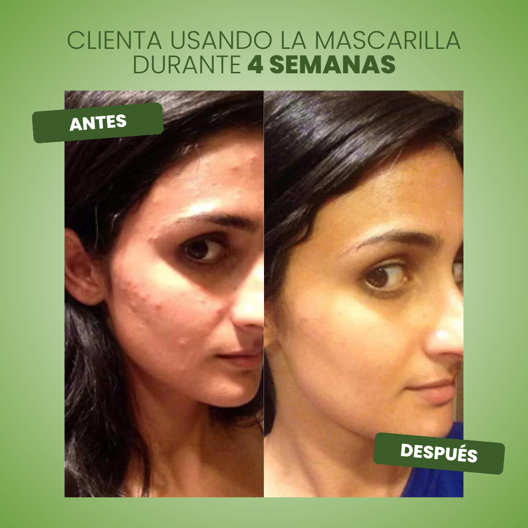 Mascarilla Verde Green Mask™ - Piel Renovada e Hidratada